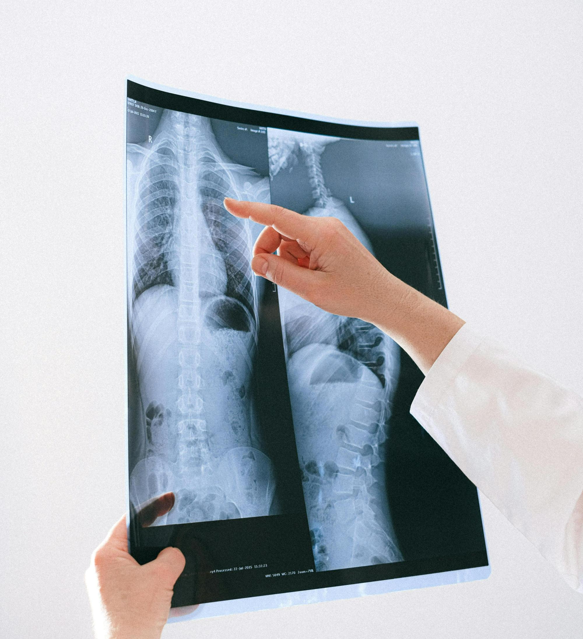 Фтизиатрия (взрослая, детская)